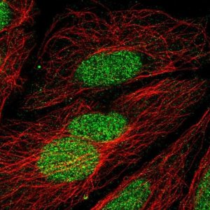 Anti-ZNF362 antibody produced in rabbit 