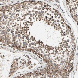 Anti-ZNF37A antibody produced in rabbit 