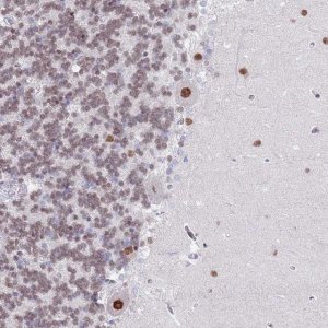 Anti-ZNF382 antibody produced in rabbit 