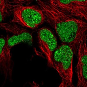 Anti-ZNF382 antibody produced in rabbit 
