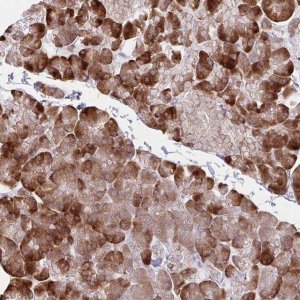 Anti-ZNF383 antibody produced in rabbit 