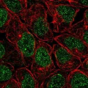 Anti-ZNF383 antibody produced in rabbit 
