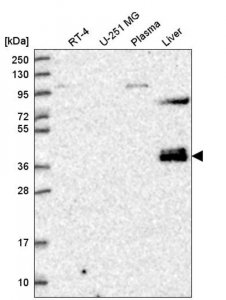 Anti-ZNF385B antibody produced in rabbit 