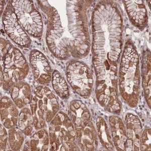 Anti-ZNF391 antibody produced in rabbit 