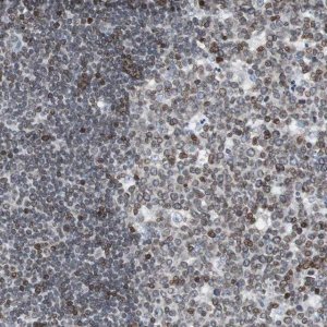 Anti-ZNF396 antibody produced in rabbit HPA006686-100UL