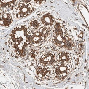 Anti-ZNF397 antibody produced in rabbit HPA026087-100UL