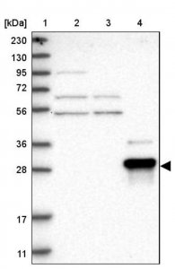 Anti-ZNF397 antibody produced in rabbit HPA026087-100UL