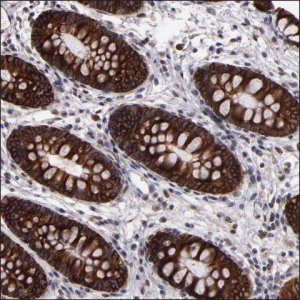 Anti-ZNF410 antibody produced in rabbit HPA002871-100UL