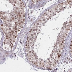 Anti-ZNF414 antibody produced in rabbit 