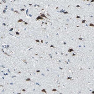 Anti-ZNF415 antibody produced in rabbit 