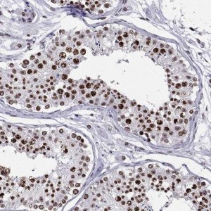 Anti-ZNF420 antibody produced in rabbit 