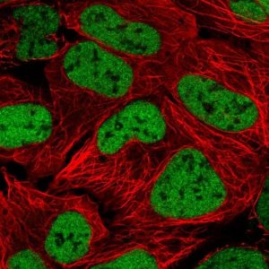 Anti-ZNF420 antibody produced in rabbit 