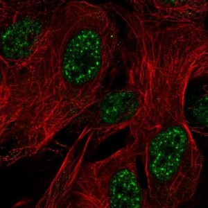 Anti-ZNF441 antibody produced in rabbit 