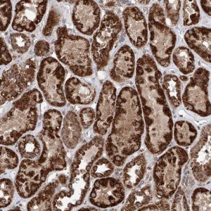 Anti-ZNF445 antibody produced in rabbit 