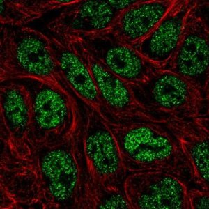 Anti-ZNF45 antibody produced in rabbit 