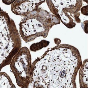Anti-ZNF451 antibody produced in rabbit HPA028838-100UL