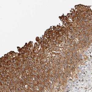 Anti-ZNF454 antibody produced in rabbit 