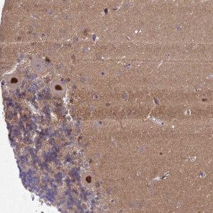 Anti-ZNF461 antibody produced in rabbit 