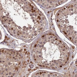 Anti-ZNF467 antibody produced in rabbit 