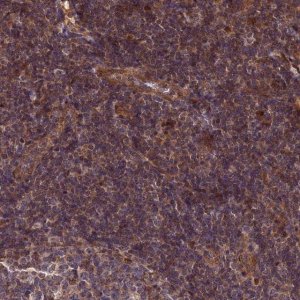 Anti-ZNF467 antibody produced in rabbit 