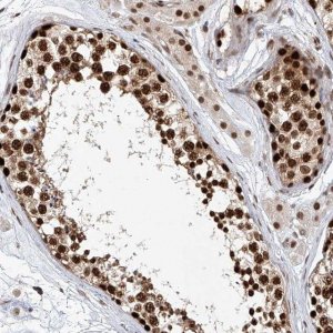 Anti-ZNF470 antibody produced in rabbit 