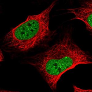 Anti-ZNF470 antibody produced in rabbit 