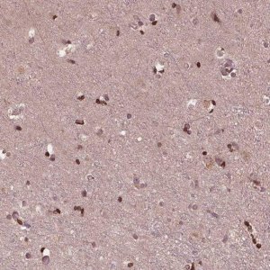Anti-ZNF471 antibody produced in rabbit HPA066695-100UL