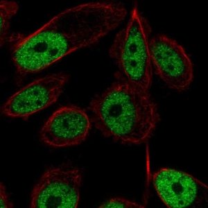 Anti-ZNF473 antibody produced in rabbit 