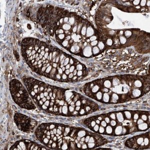 Anti-ZNF484 antibody produced in rabbit 