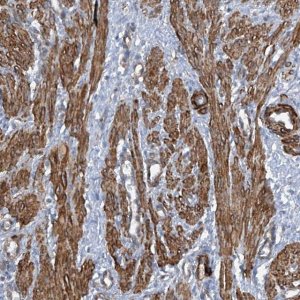 Anti-ZNF490 antibody produced in rabbit 