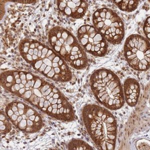 Anti-ZNF497 antibody produced in rabbit 