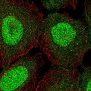 Anti-ZNF497 antibody produced in rabbit 