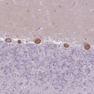 Anti-ZNF501 antibody produced in rabbit 