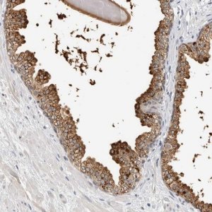 Anti-ZNF502 antibody produced in rabbit 