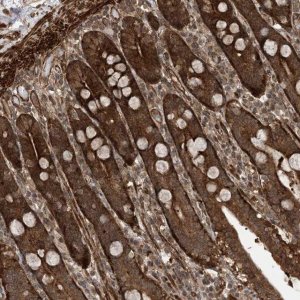 Anti-ZNF511 antibody produced in rabbit 