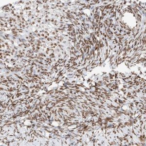 Anti-ZNF512 antibody produced in rabbit 