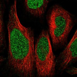 Anti-ZNF512 antibody produced in rabbit 