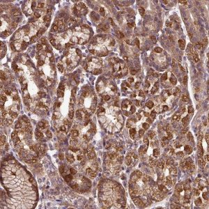 Anti-ZNF513 antibody produced in rabbit 