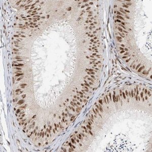 Anti-ZNF514 antibody produced in rabbit 