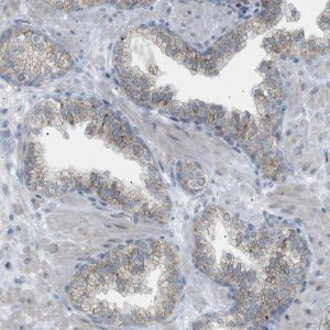 Anti-ZNF516 antibody produced in rabbit 