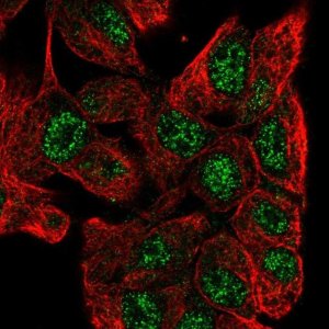 Anti-ZNF517 antibody produced in rabbit 