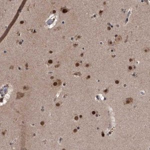 Anti-ZNF518B antibody produced in rabbit 