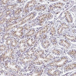 Anti-ZNF526 antibody produced in rabbit 