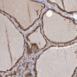 Anti-ZNF527 antibody produced in rabbit 
