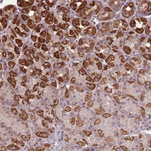 Anti-ZNF530 antibody produced in rabbit 