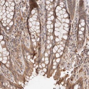 Anti-ZNF543 antibody produced in rabbit 