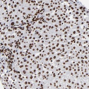 Anti-ZNF544 antibody produced in rabbit 