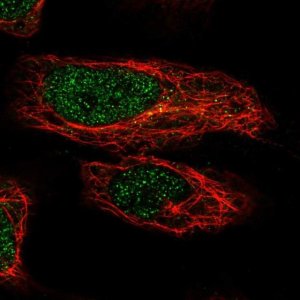 Anti-ZNF548 antibody produced in rabbit 