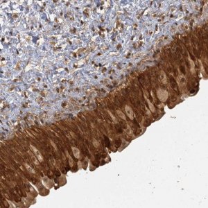 Anti-ZNF549 antibody produced in rabbit 