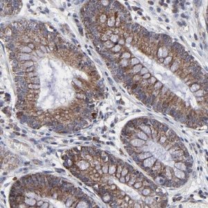 Anti-ZNF550 antibody produced in rabbit 